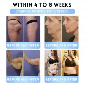 Slim & Firm 𝑁ano 𝑀icroneedle 𝑃atch - Image 14