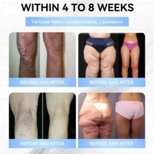 Slim & Firm 𝑁ano 𝑀icroneedle 𝑃atch - Image 15