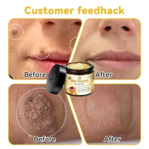 Bee Venom Skin Treatment Cream - Image 4