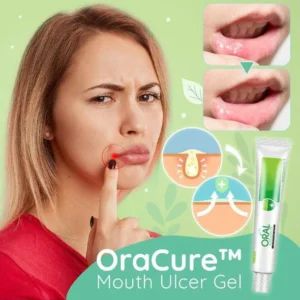Mouth Ulcer Gel - Image 2
