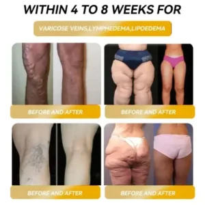 𝐌𝐚𝐠𝐧𝐞𝐭𝐢𝐜 𝐄𝐧𝐞𝐫𝐠𝐲 𝐆𝐞-𝐒𝐭𝐨𝐧𝐞 𝐌𝐚𝐩𝐥𝐞 𝐄𝐚𝐫𝐫𝐢𝐧𝐠𝐬 - Image 2