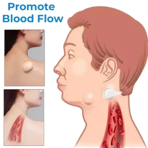 Lipoma Treatment Ointment - Image 4