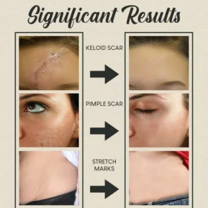 🔥Organic Skin Rebound Cream - Image 5