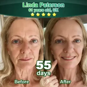 𝗦𝘁𝗲𝗺 𝗖𝗲𝗹𝗹–𝗔𝗰𝘁𝗶𝘃𝗮𝘁𝗲𝗱 𝗖𝗼𝗹𝗹𝗮𝗴𝗲𝗻 𝗣𝗲𝗽𝘁𝗶𝗱𝗲 𝗱𝗿𝗼𝗽𝘀 - Image 3