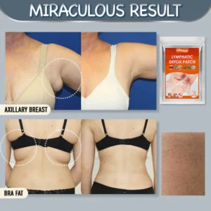 Armpit Fat Removal Lymphatic Pad - Image 2