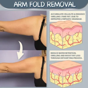Armpit Fat Removal Lymphatic Pad - Image 3