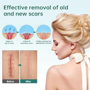 Natural Scar Removal Spray - Image 4