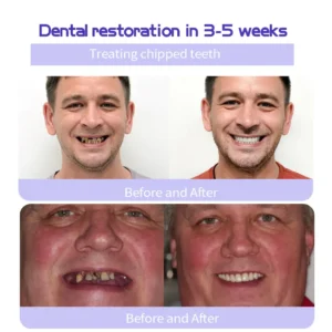 Winter Sale Teeth Restoration Mineral Powder - Image 6