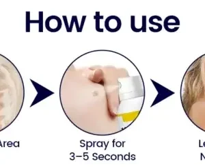 WartErase Cryo Freeze Spray - Image 8