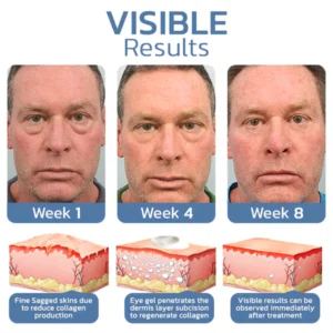 BLUESKY ™ OPENEYES Awaken Peptide Lifting Eye Gel - Image 4