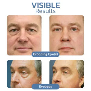 BLUESKY ™ OPENEYES Awaken Peptide Lifting Eye Gel - Image 6
