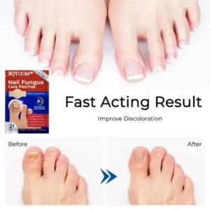 Nail Fungus Care Patches - Image 5