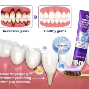 Tongue Coating Cleaning Gel - Image 3