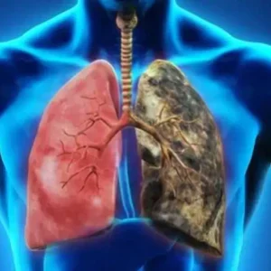 BREATHE-RIGHT DENDROBIUM & MULLEIN EXTRACT: POWERFUL LUNG SUPPORT CLEANSE & RESPIRATORY - Image 3