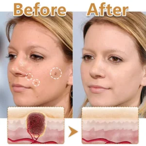 BeeVenom Wart Drop Serum - Image 4