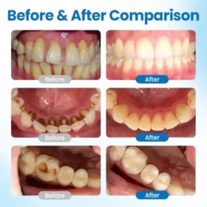 NanoHAP Tooth Defense Serum - Image 2