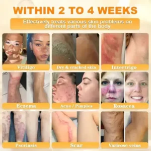 Bee Venom Skin Restoration Cream - Image 4