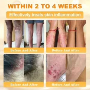 Bee Venom Skin Restoration Cream - Image 5