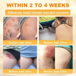 Bee Venom Skin Restoration Cream - Image 9