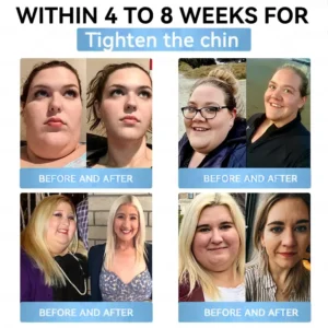 𝐏𝐫𝐨 𝐌𝐞𝐭𝐚𝐛𝐨𝐥𝐢𝐜 𝐑𝐞𝐠𝐮𝐥𝐚𝐭𝐢𝐨𝐧 𝐎𝐫𝐚𝐥 𝐒𝐩𝐫𝐚𝐲 - Image 5