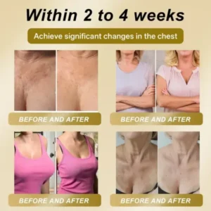 ROYAL JELLY FIRMING & LIFT PATCH - Image 4