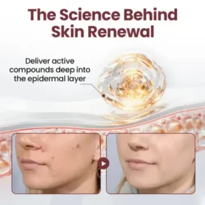 KeraErase RICEDUAL-ACTION RENEWAL CREAM - Image 4