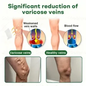 VeinLock Microneedle Patch - Image 3
