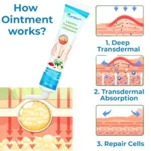 Lipoma Treatment Ointment - Image 2