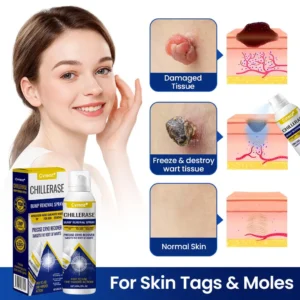 ChillErase Bump Renewal Spray - Image 7