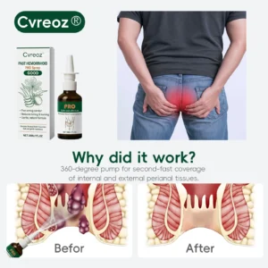 Fast Hemorrhoid PRO Spray - Image 4