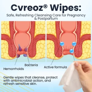 Herbal Hemorrhoid Treatment Anal Spray + Wipes - Image 4