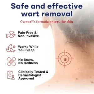 Mole and Wart Removal Cream - Image 4