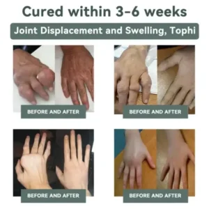 Nerve Repair &Pain Relief Magnesium Cream - Image 4