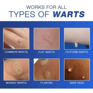 Wart Eraser Pro - Image 6