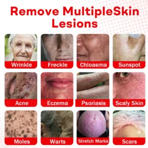 MicroNeedle BotanicSkin Tag Removal Patch - Image 11