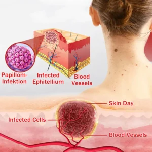MicroNeedle BotanicSkin Tag Removal Patch - Image 9