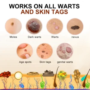 PRO Bee Venom Mole and Wart Treatment Cream - Image 2