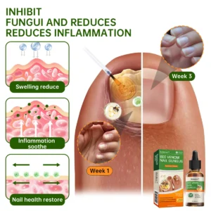 Bee Venom Nail Fungus Treatment Liquid - Image 6