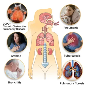 herbal lung cleansing inhaler - Image 3