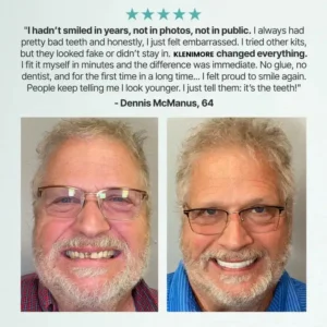 Medical Full Denture with Strong Suctiond - Image 11