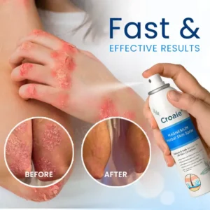 Magnesium Herbal Skin Spray - Image 3