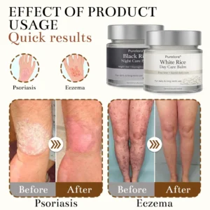 Black and White Rice Day and Night Dual Repair Cream - Image 3