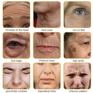 Botox Bee Venom Wrinkle Removal Cream - Image 3