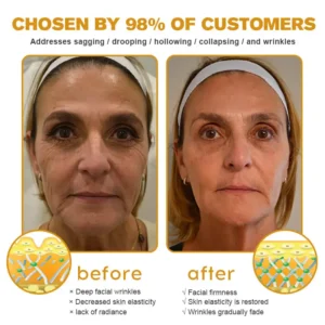 Botox Bee Venom Wrinkle Removal Cream - Image 4