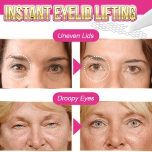 Glue-Free Invisible Eyelid Tape - Image 3
