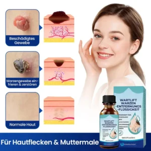 WartLift Wart Removal Fluid - Image 3