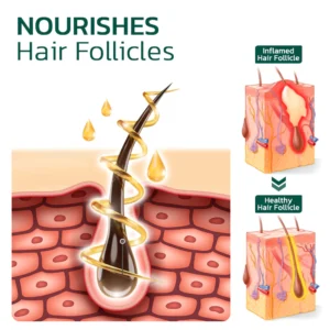 Scalp Folliculitis Therapy Oil - Image 2