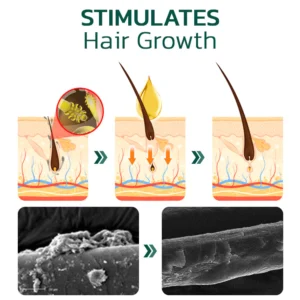 Scalp Folliculitis Therapy Oil - Image 4