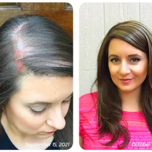 Scalp Folliculitis Therapy Oil - Image 7