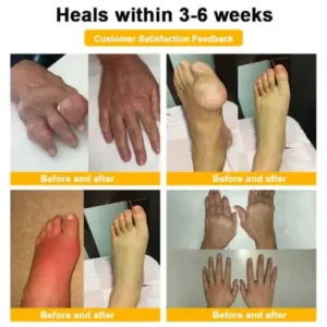 BEE VENOM LITHOSPERMUM Pain-Relief Bone Healing Cream - Image 8
